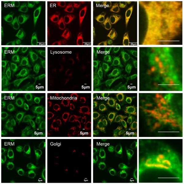 ER-Protein_Capture_Kit-F4.png