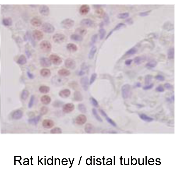 PP-H9929A-00_1.png