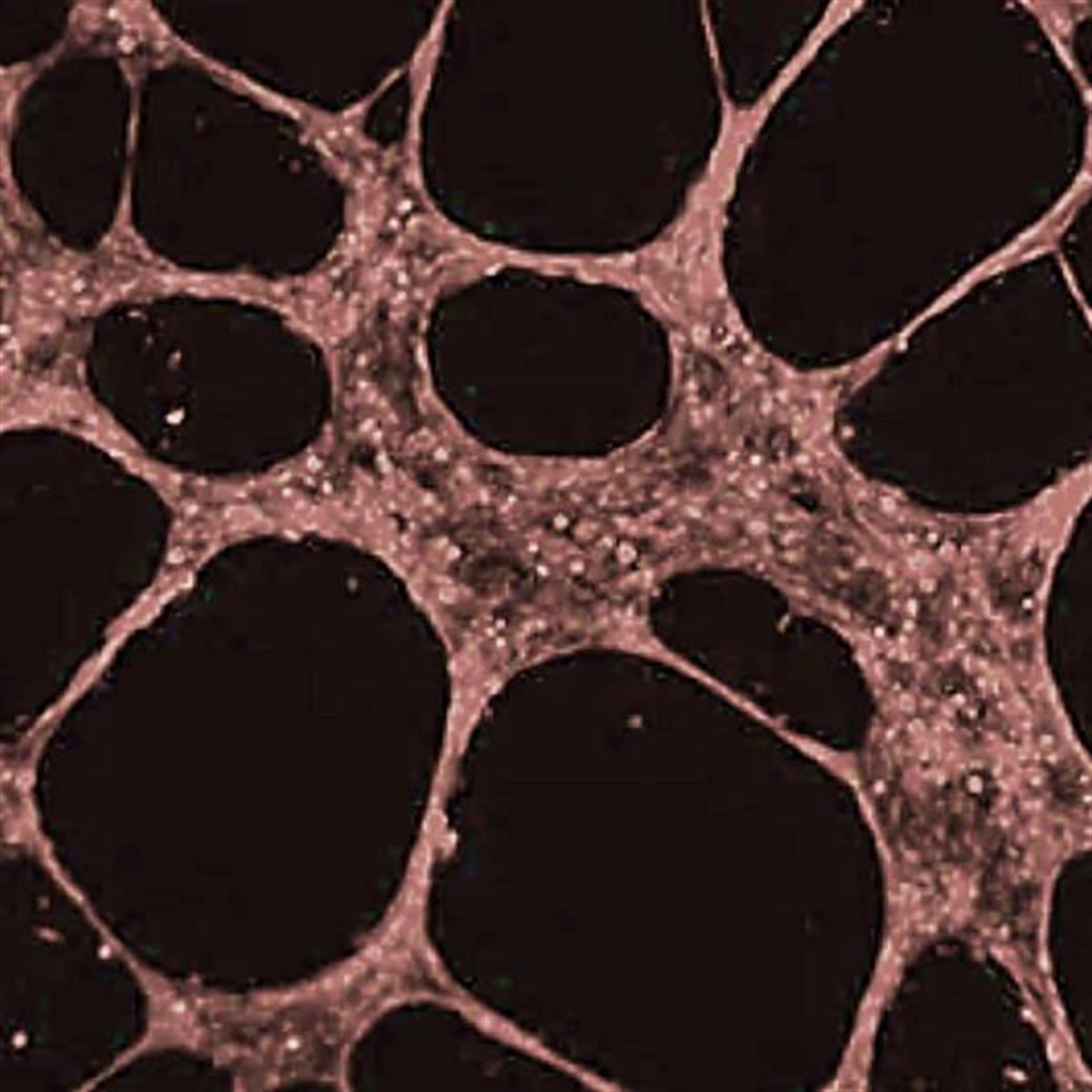 /Content/Upload/Product/AngioFlamma749_diagnocine_1200.jpg