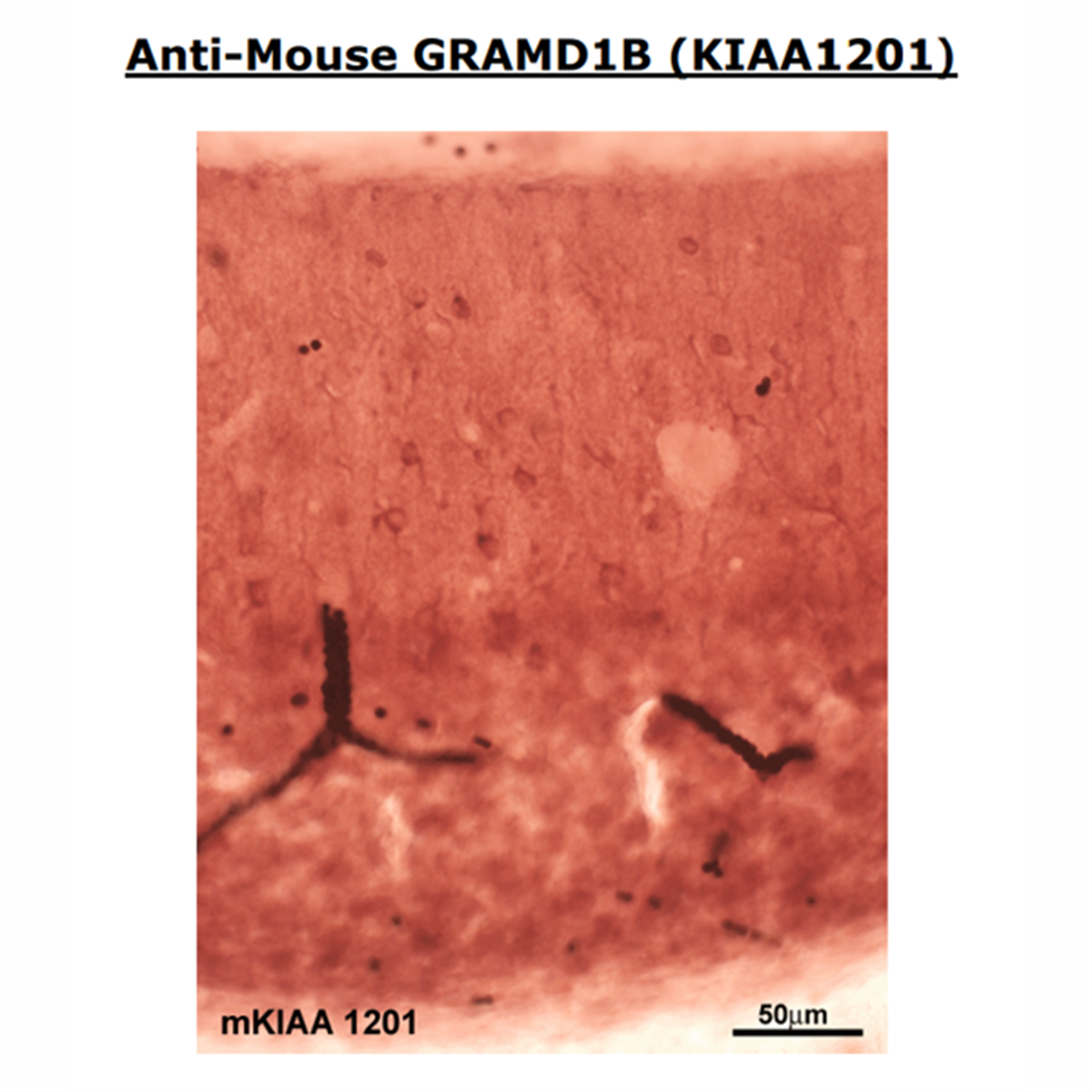 /Content/Upload/Product/Anti-GRAMD1B-1_1200.png
