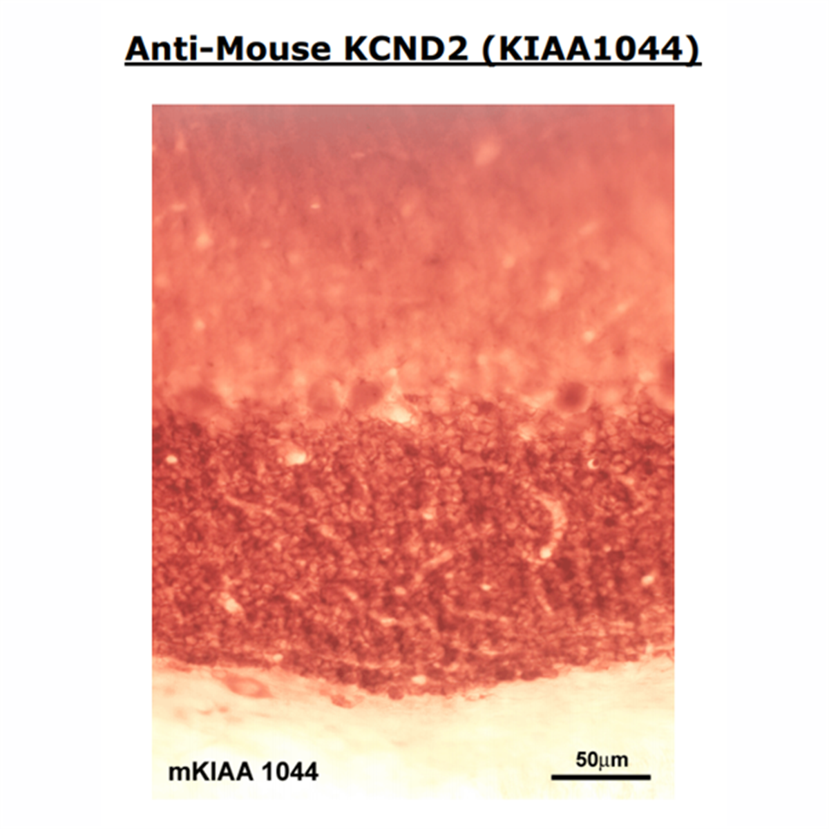 /Content/Upload/Product/Anti-KCND2-1_1200.png