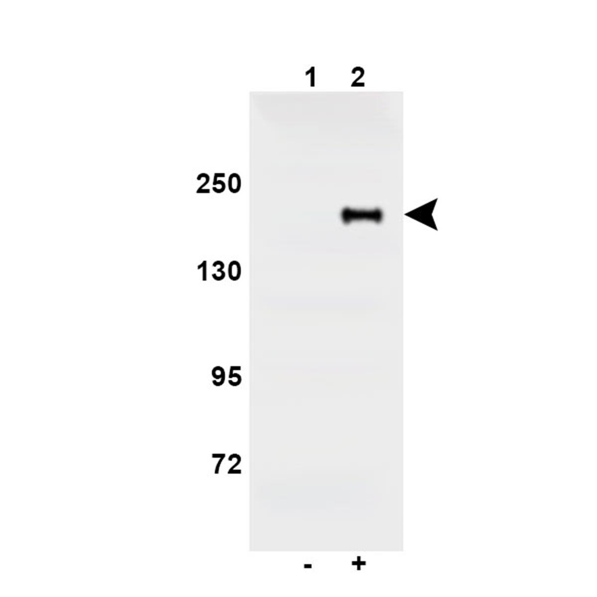 /Content/Upload/Product/Anti-Mouse-EHMT1-(KIAA1876)-Polyclonal-Antibody_Rabbit_w600x600_Diagnocine_1200.jpg