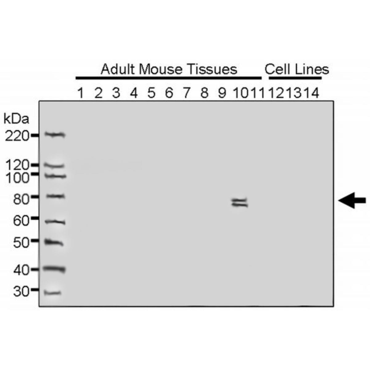 /Content/Upload/Product/Anti-Mouse-KLHL9_KIAA1354_MK13540310_w1200_Diagnocine_1200.jpg