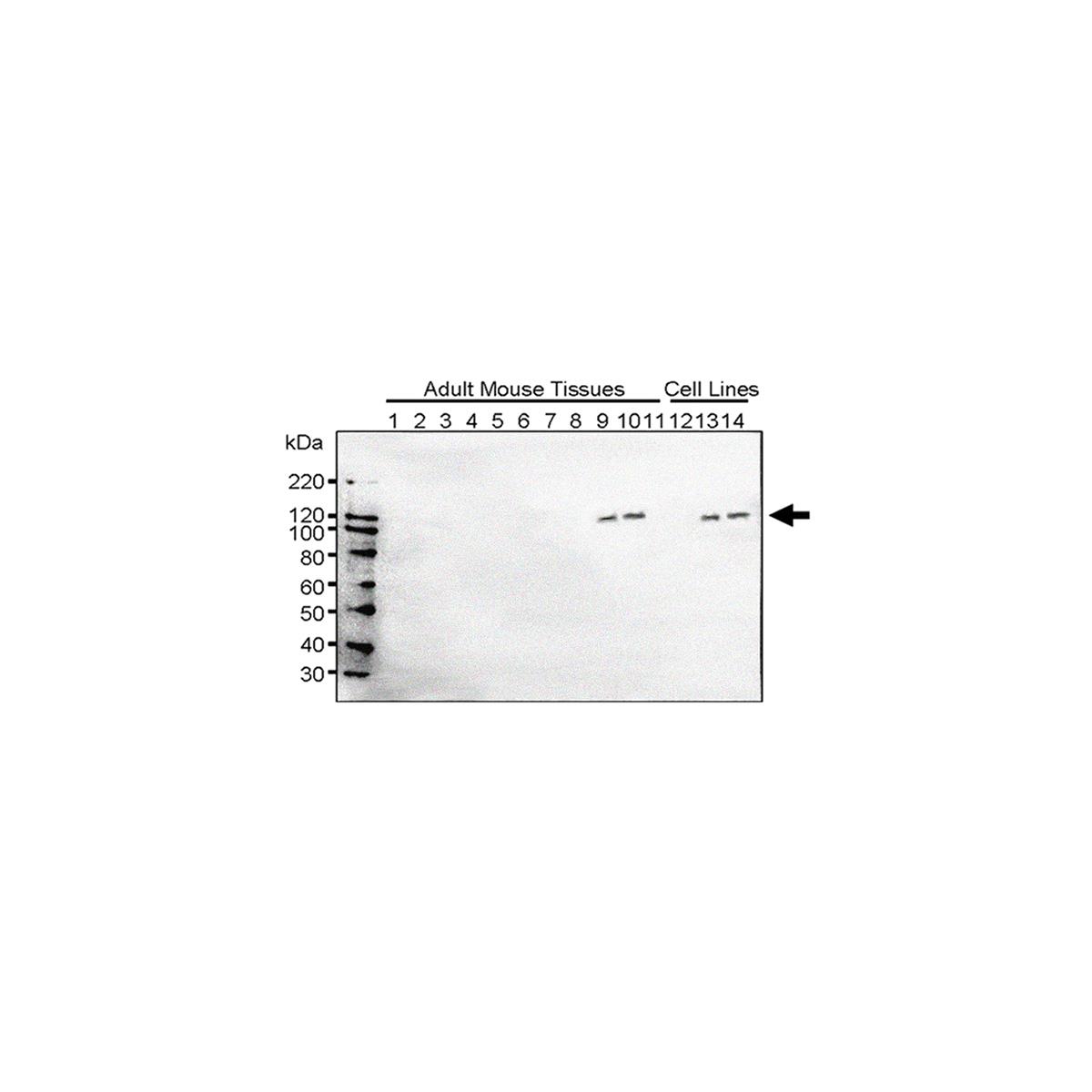/Content/Upload/Product/Anti-Mouse-TSC1_Polyclonal-Antibody_KIAA0243_MK02430310_w1200_Diagnocine_1200.jpg