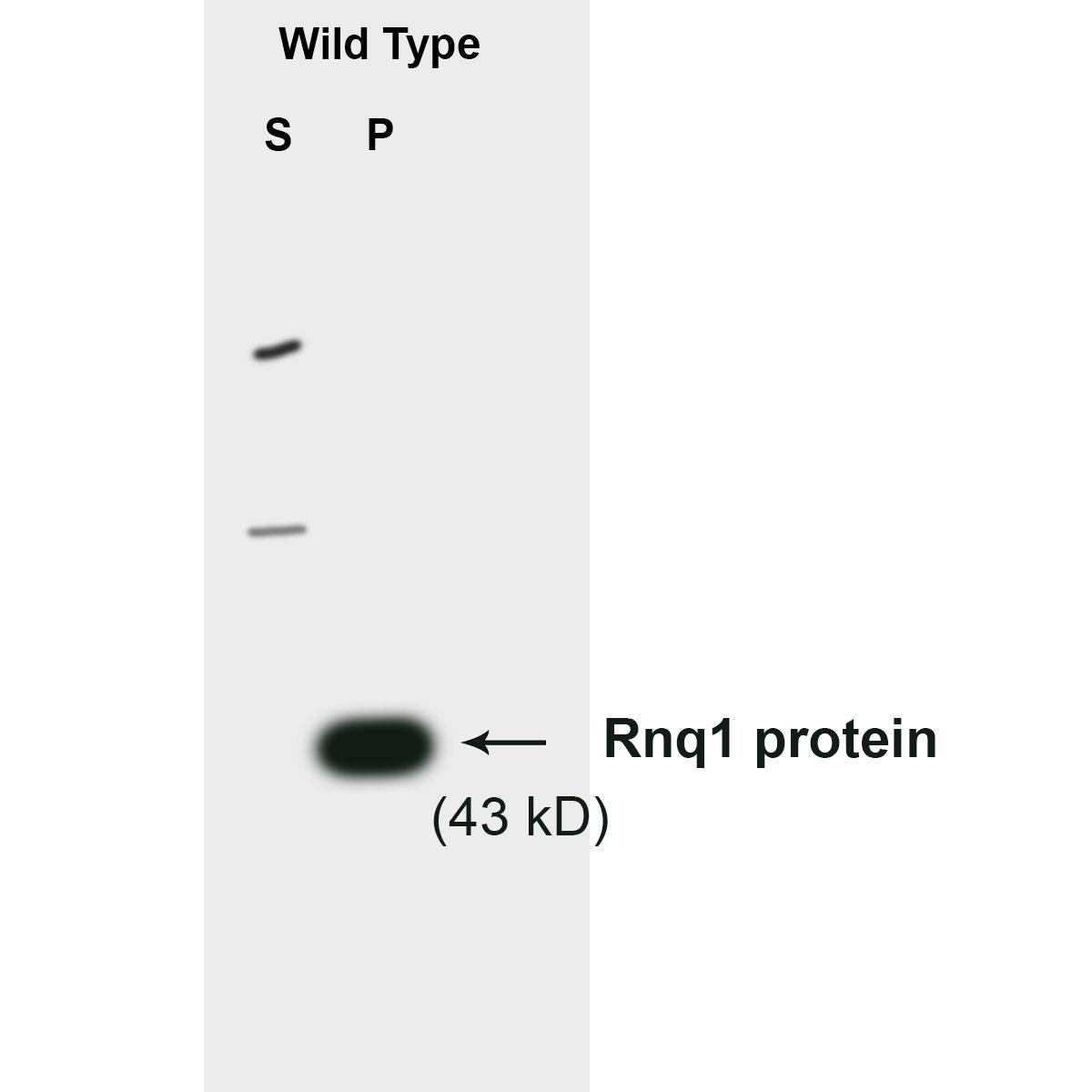 /Content/Upload/Product/Anti-Rnq1_S-cerevisiae_antibody-affinity-purified_62-301_W1200_Diagnocine_1200.jpg