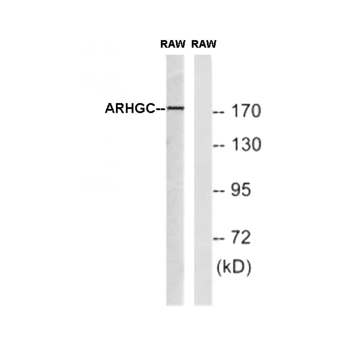 /Content/Upload/Product/Anti_Mouse_ARHGEF12_KIAA0382_MKA0382AF_w1200_Diagnocine_1200.jpg