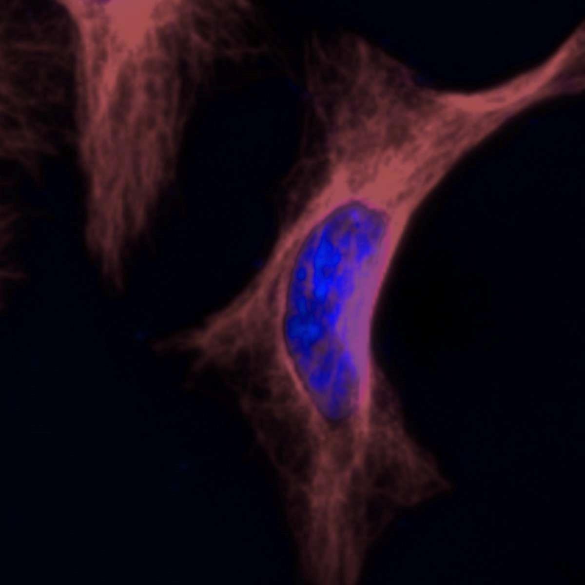 /Content/Upload/Product/BiotinFlamma675_1200_2.jpg