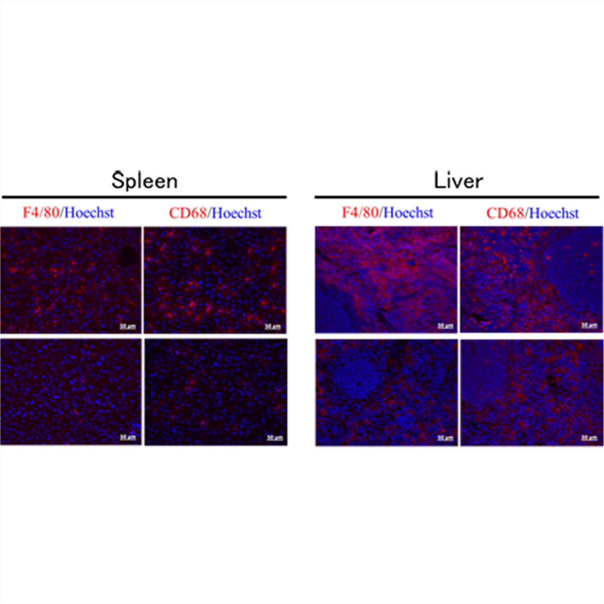 /Content/Upload/Product/Clodronate_Liposome_Diagnocine_1200_1200.png