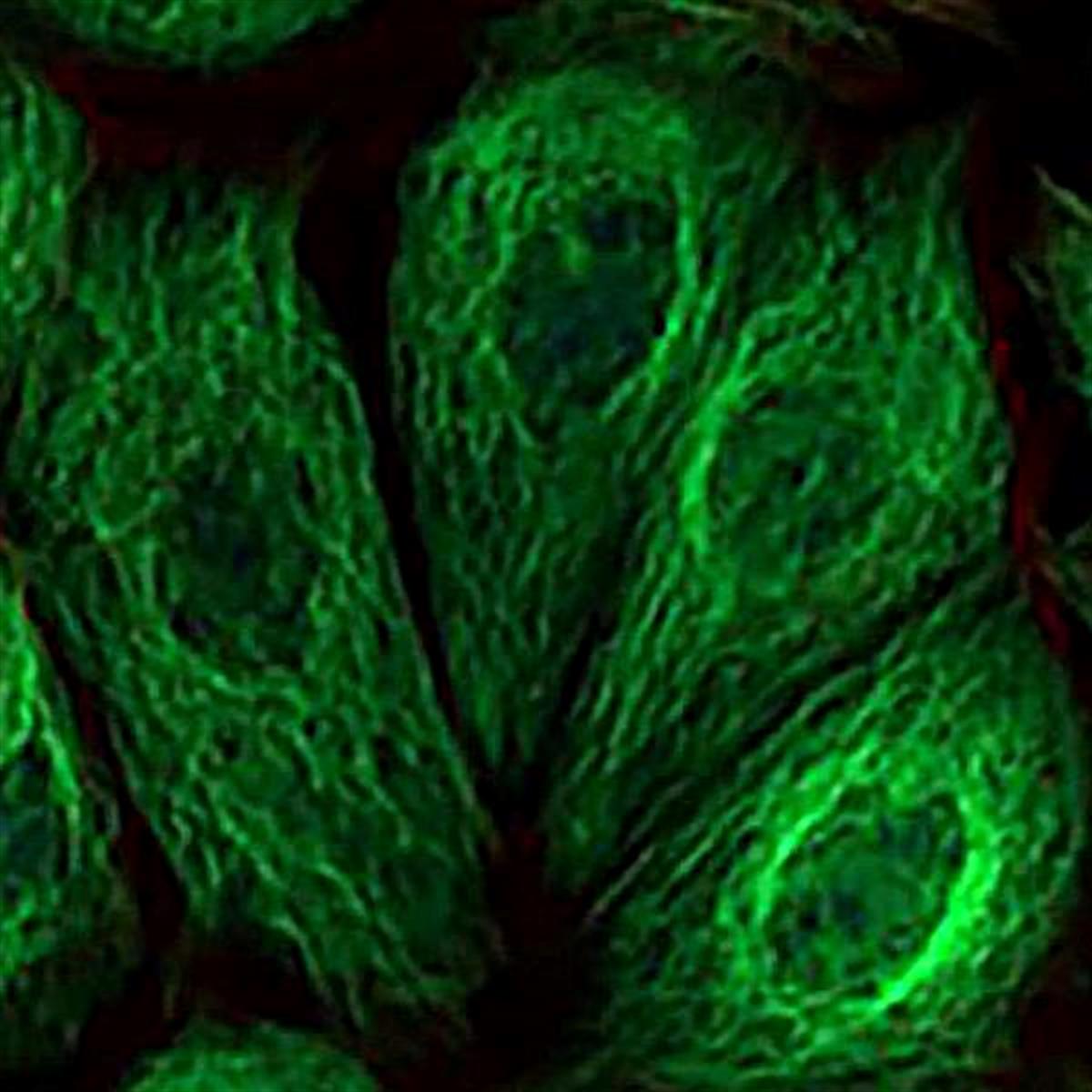 /Content/Upload/Product/FAMADIBO_diagnocine_1200.jpg