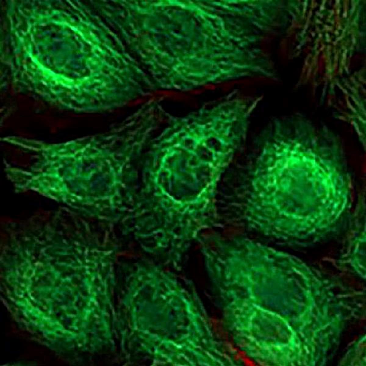 /Content/Upload/Product/FAMAzide_diagnocine_1200.jpg