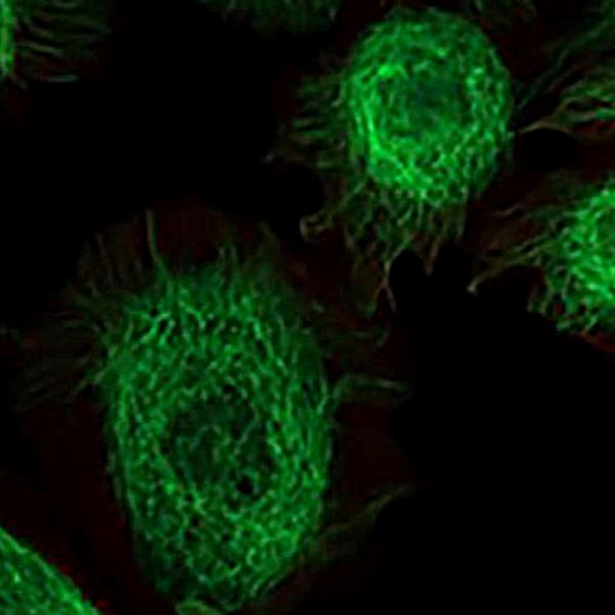 /Content/Upload/Product/FAMThiol_diagnocine_1200.jpg