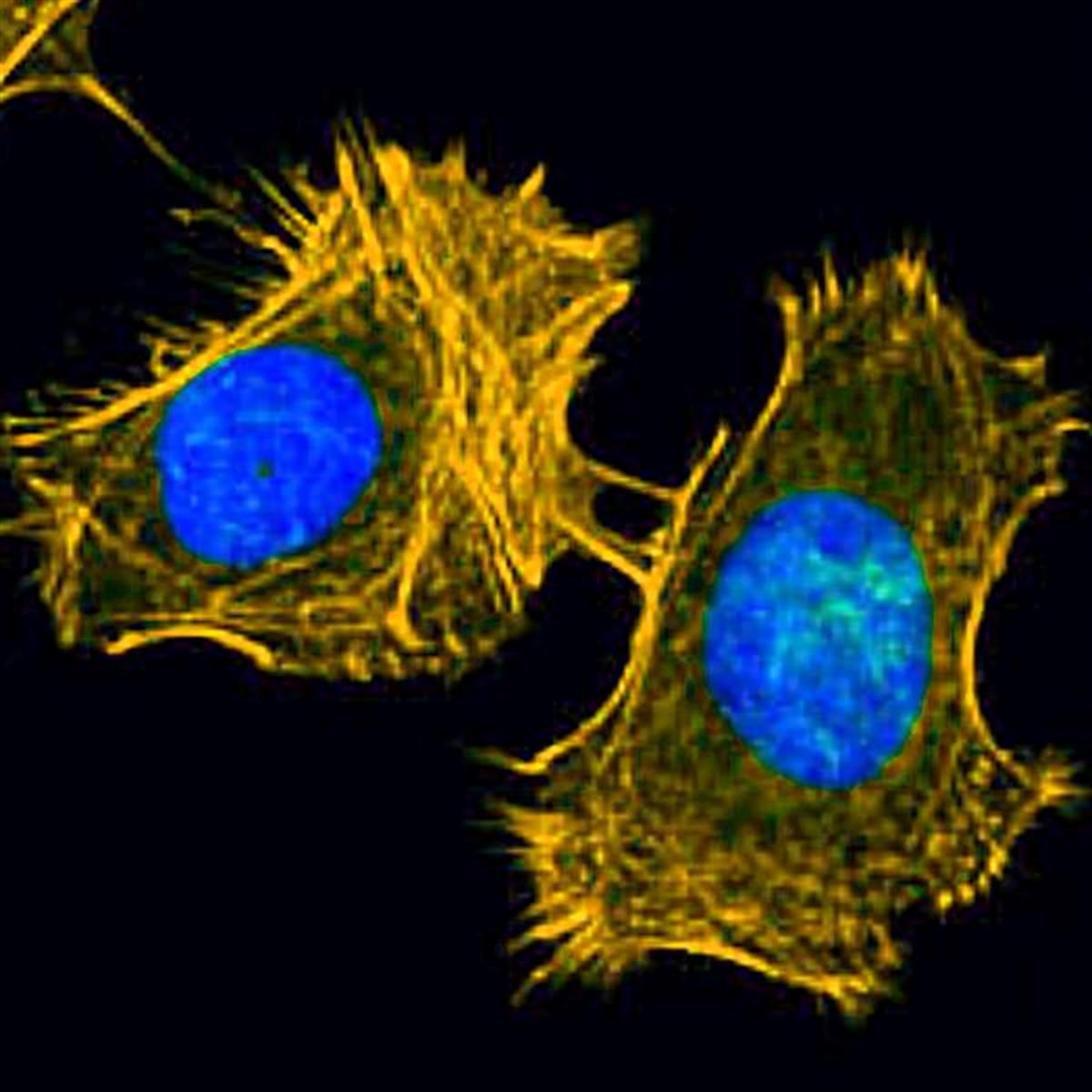 /Content/Upload/Product/FSDFluor555Phalloidin_diagnocine_1200.jpg