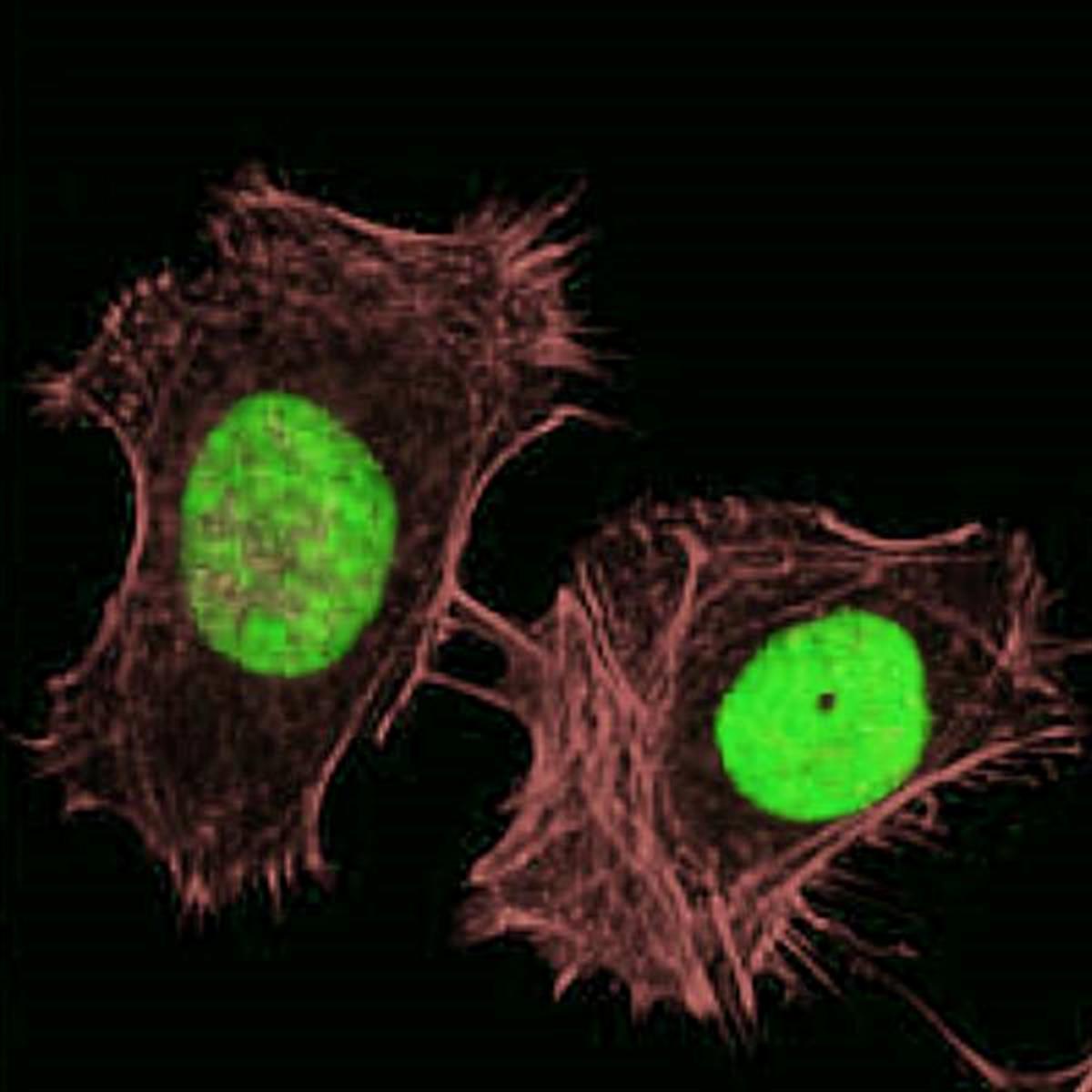 /Content/Upload/Product/FSDFluor680Phalloidin_diagnocine_1200.jpg