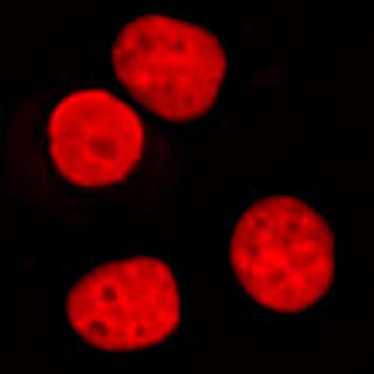 /Content/Upload/Product/Flamma648Alkyne_1200.jpg