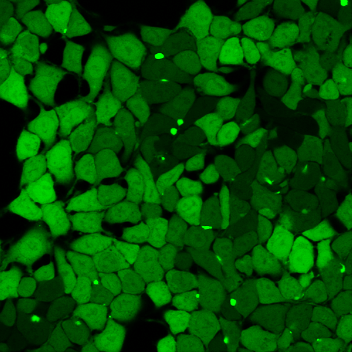 /Content/Upload/Product/GSTs_probe-600x600_Diagnocine_1200.png