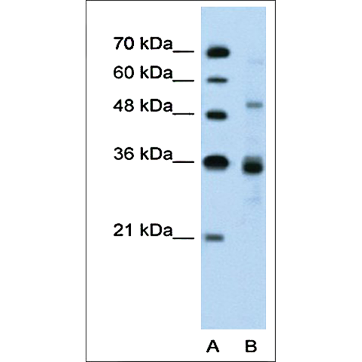 /Content/Upload/Product/KB7008GNPAF_1200.png