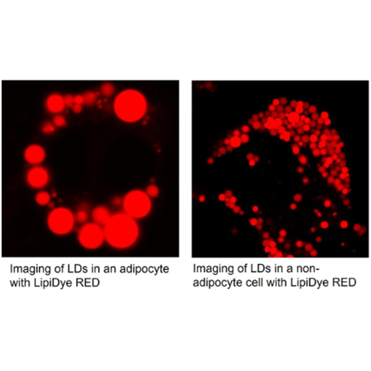 /Content/Upload/Product/LipiDye-RED_FNK-FDV-0057_Diagnocine_1200.jpg