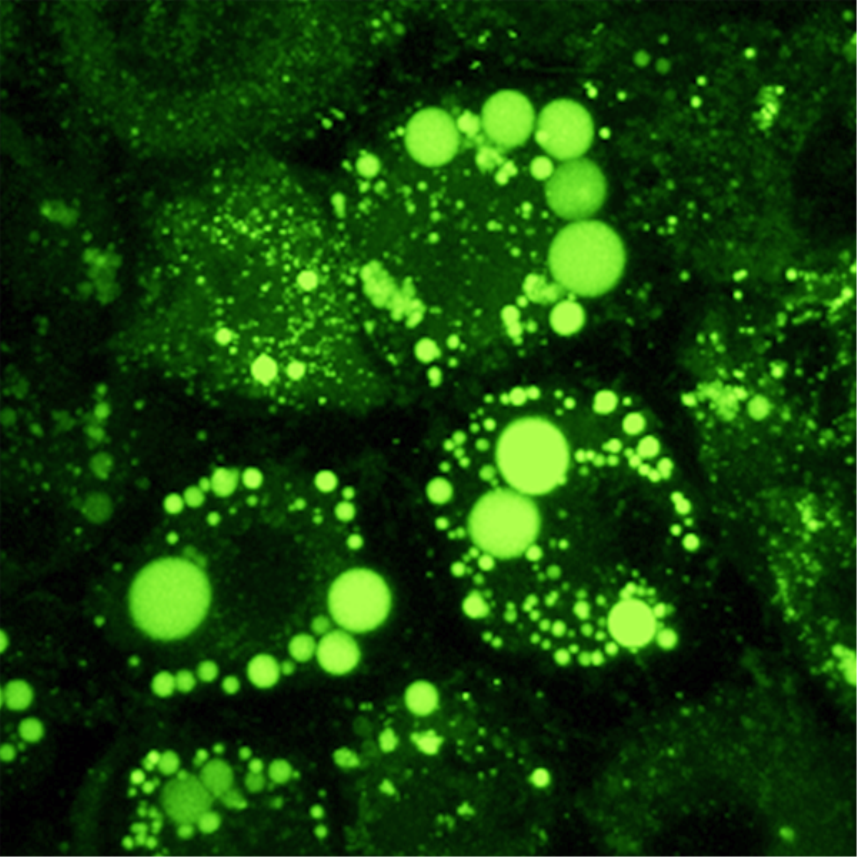 /Content/Upload/Product/LipiDye_600x600_Diagnocine_1200.png