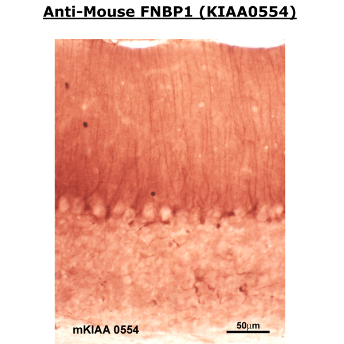 /Content/Upload/Product/MK05540310_fig1_1200.png