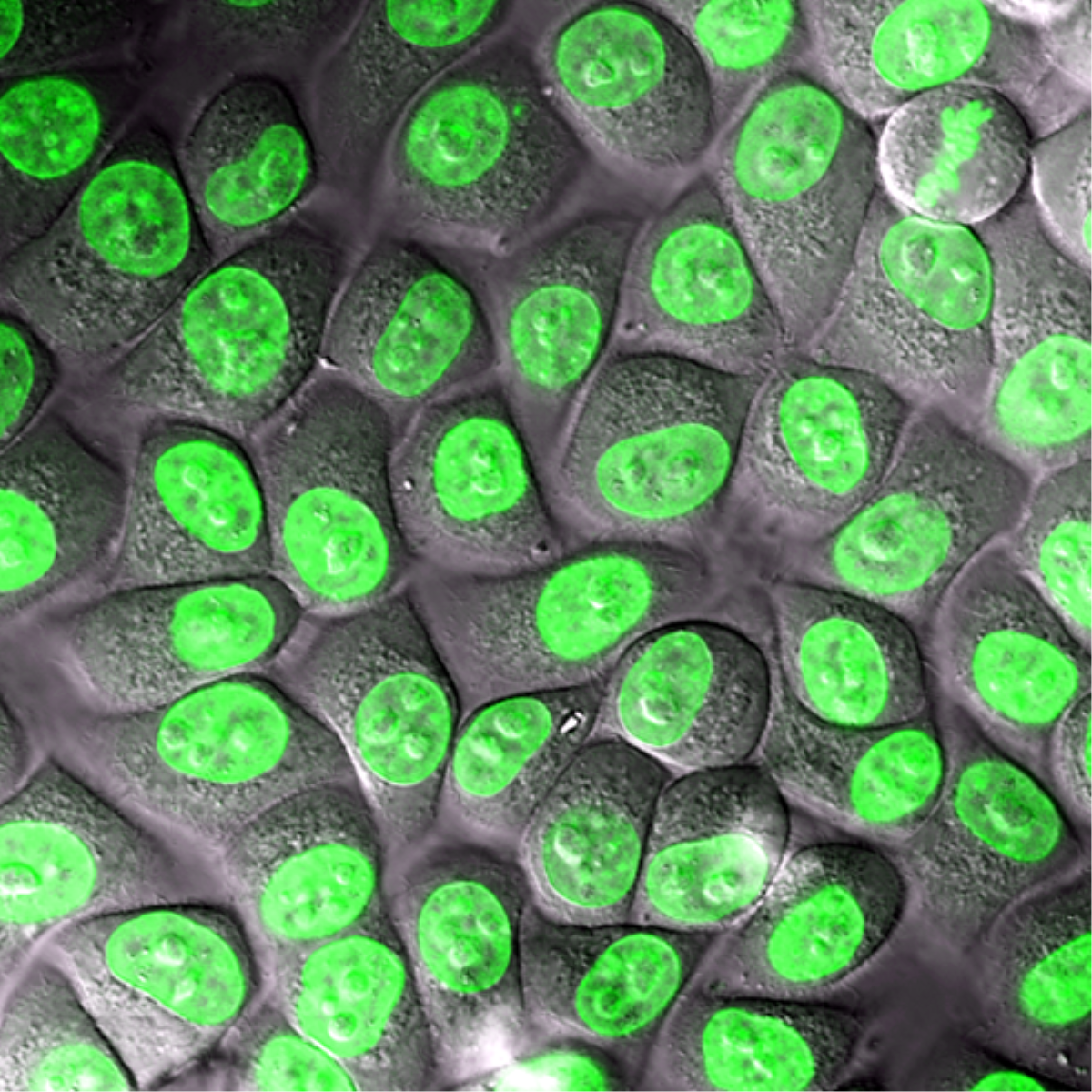 /Content/Upload/Product/NucleoSeeing_w600_diagnocine_1200.png