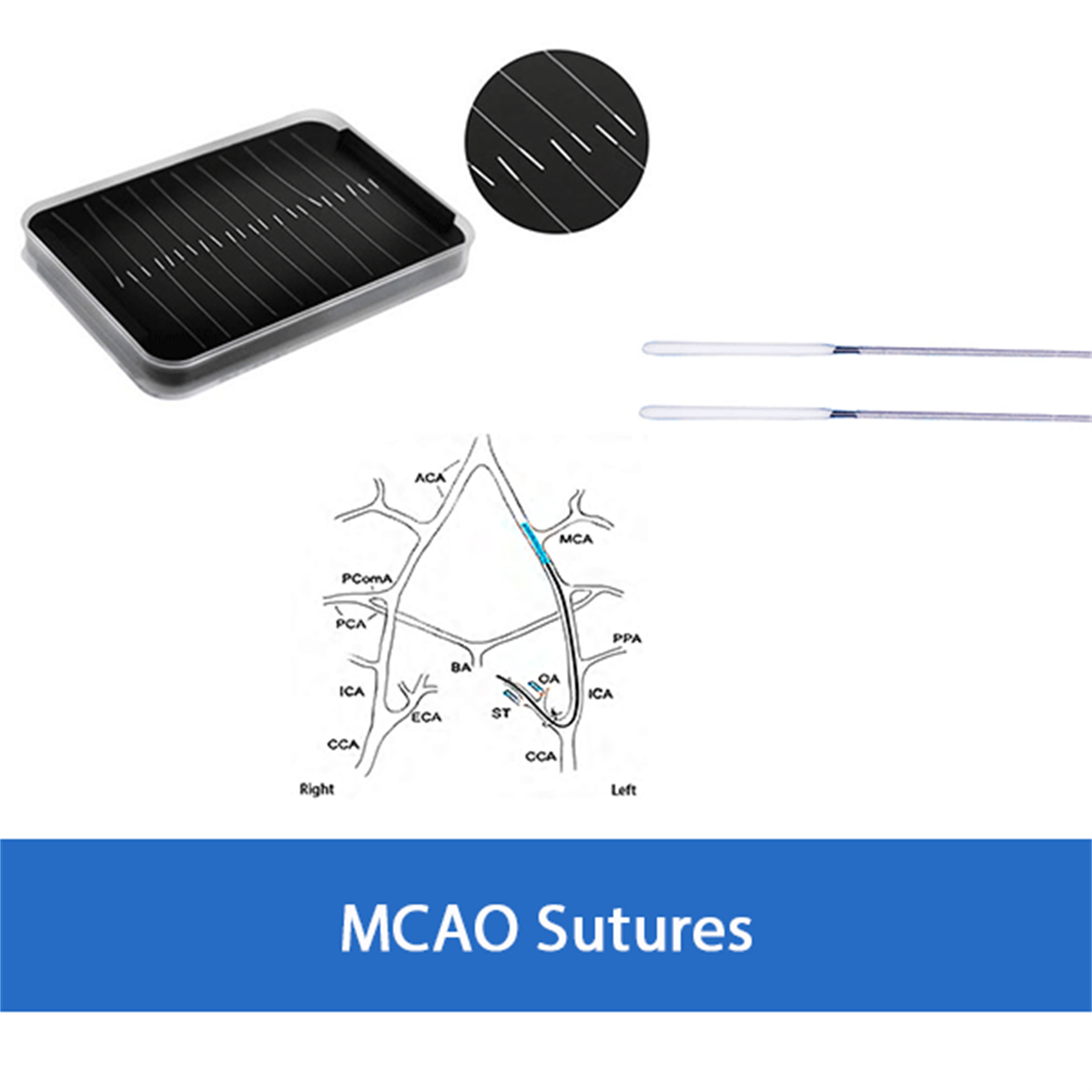 /Content/Upload/Product/RWD-MCAO-Sutures-diagnocine_1200.png