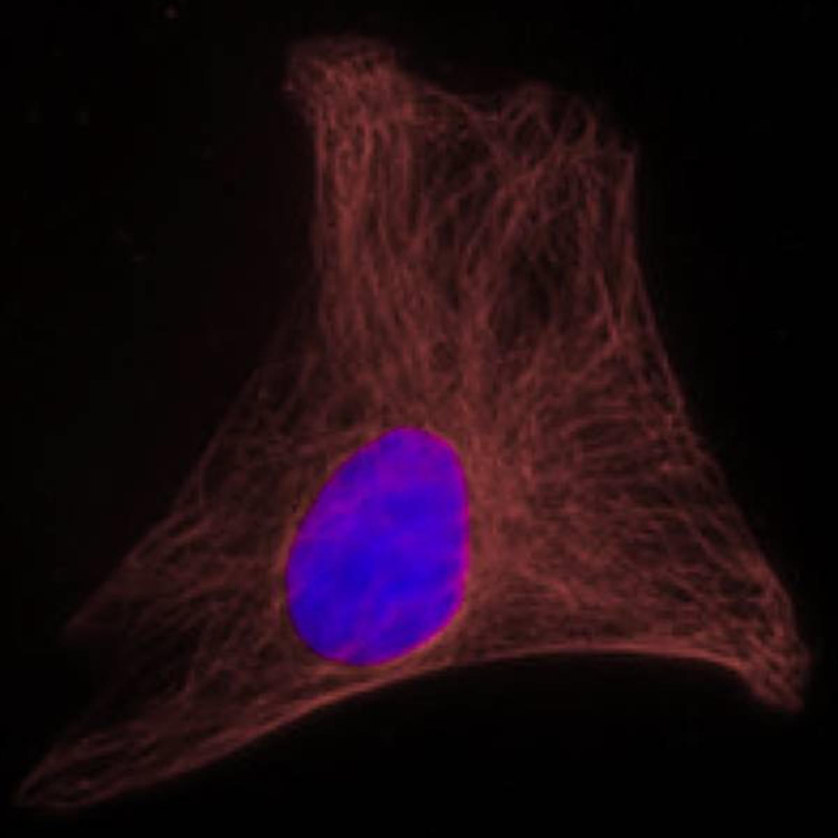 /Content/Upload/Product/Rabbitanti-goatIgGFSD680_diagnocine_1200.jpg