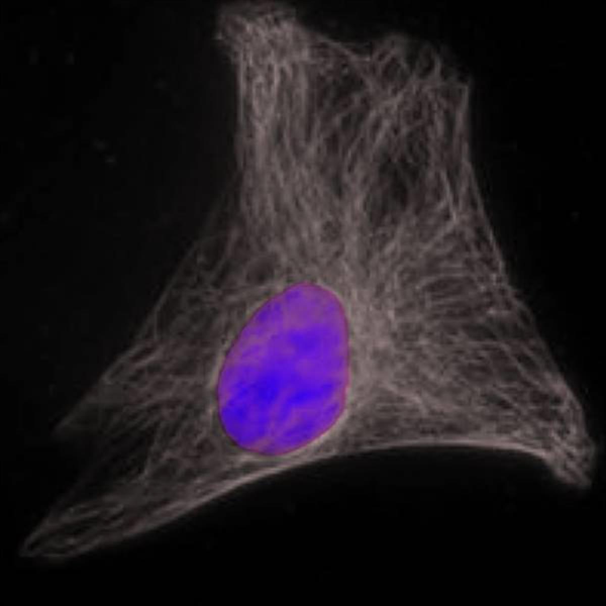 /Content/Upload/Product/Rabbitanti-goatIgGFSD800_diagnocine_1200.jpg