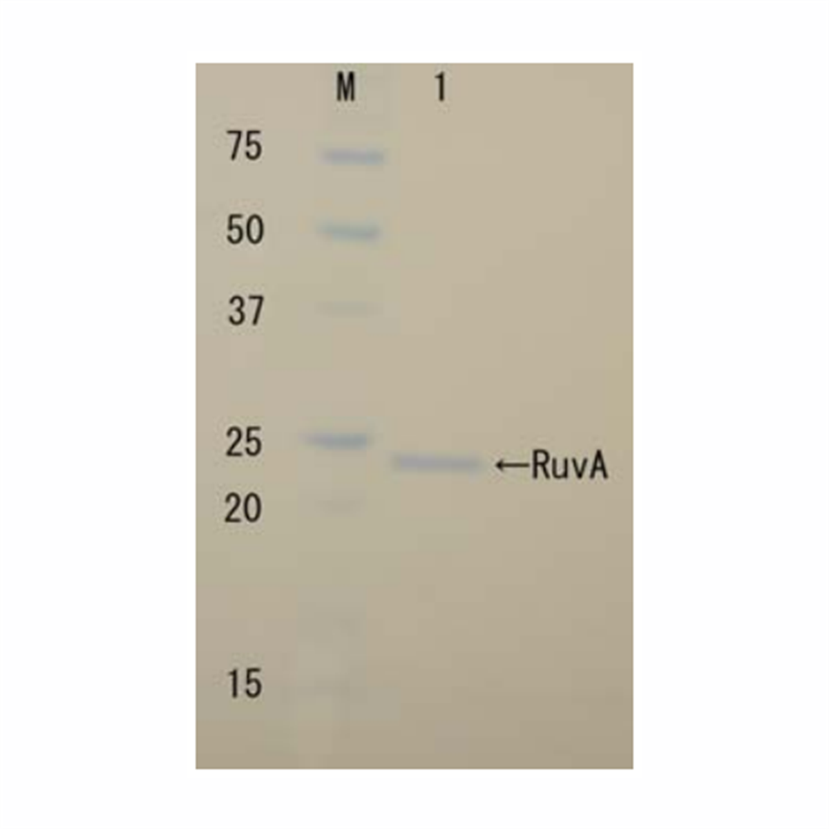 /Content/Upload/Product/RuvA_Recombinant-1_1200_1.png