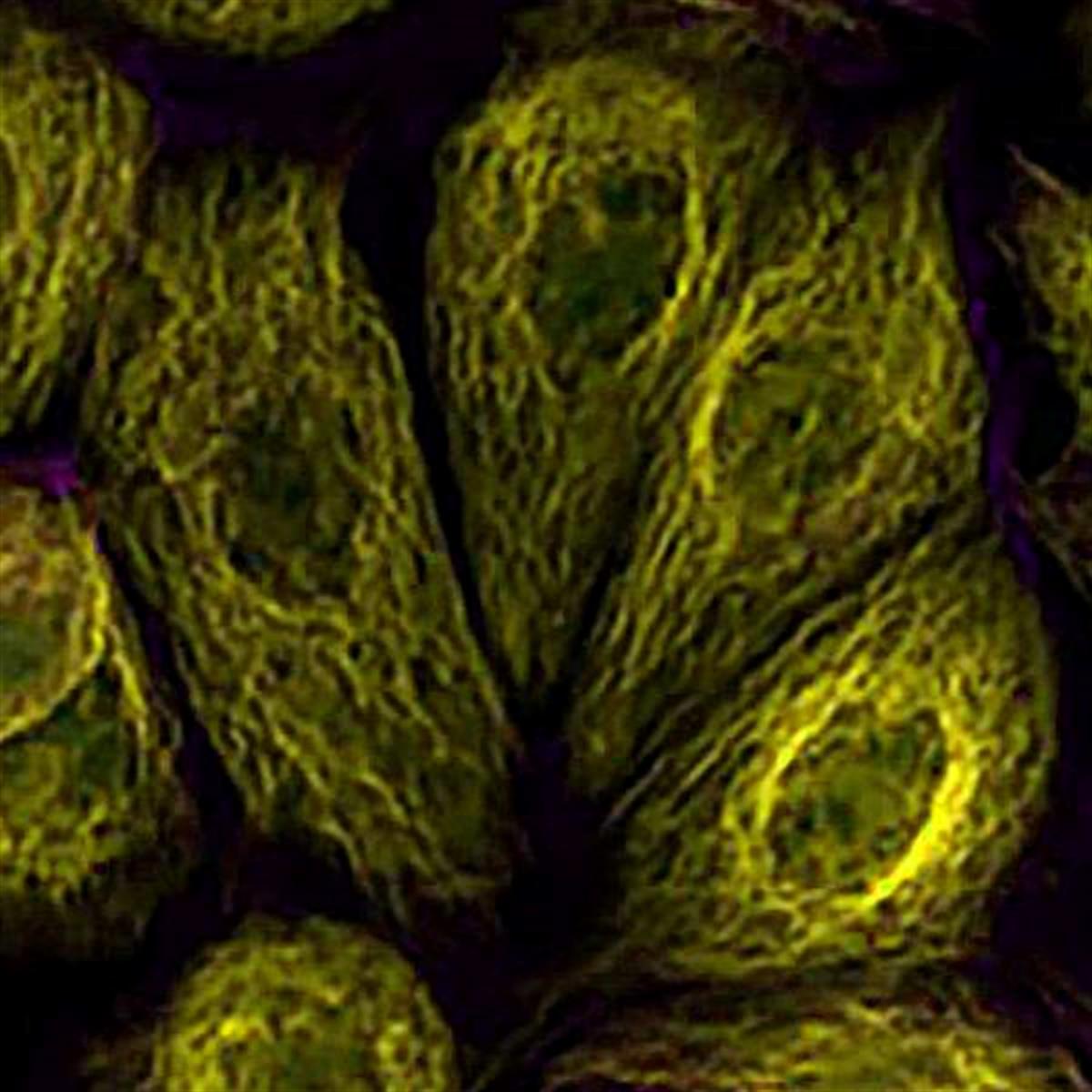 /Content/Upload/Product/TAMRANHSester_diagnocine_1200.jpg