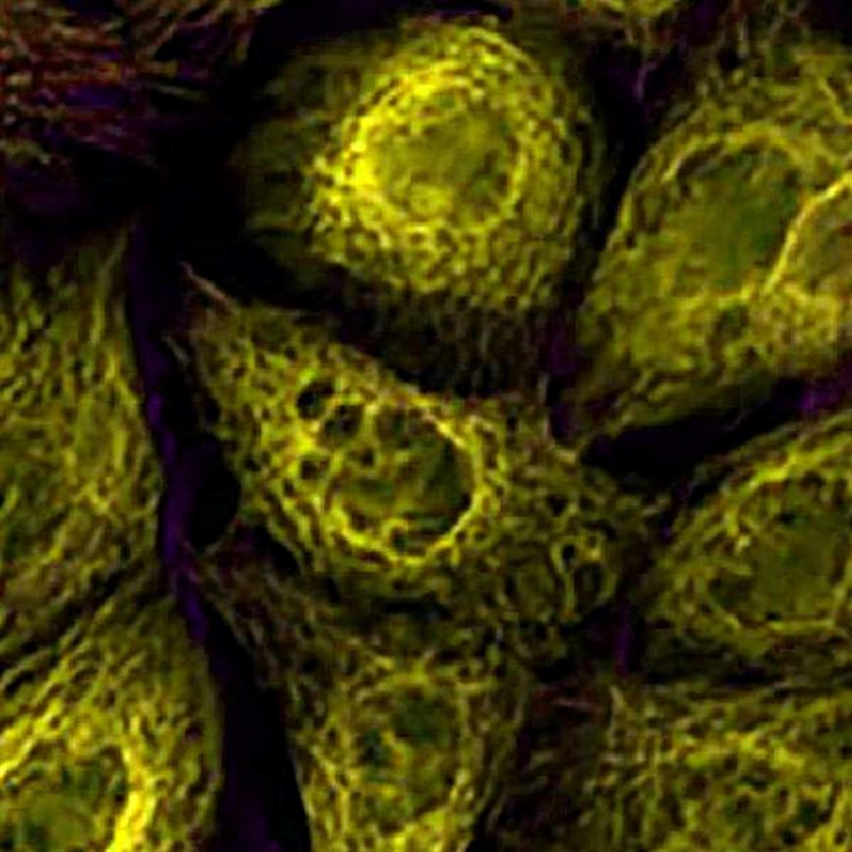 /Content/Upload/Product/TAMRAVinylsulfone_diagnocine_1200.jpg