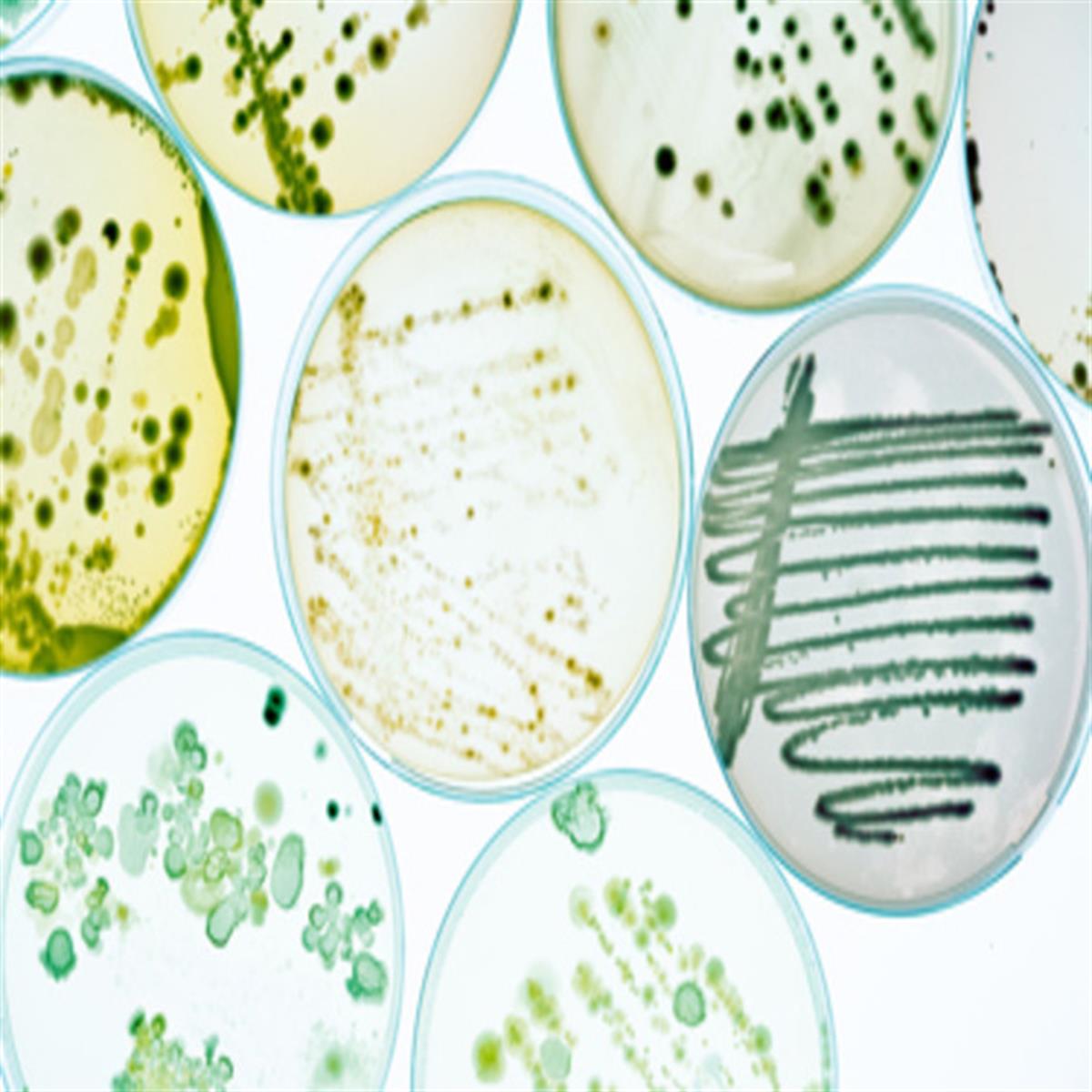 /Content/Upload/Product/bacteriaplates2_1200.jpg